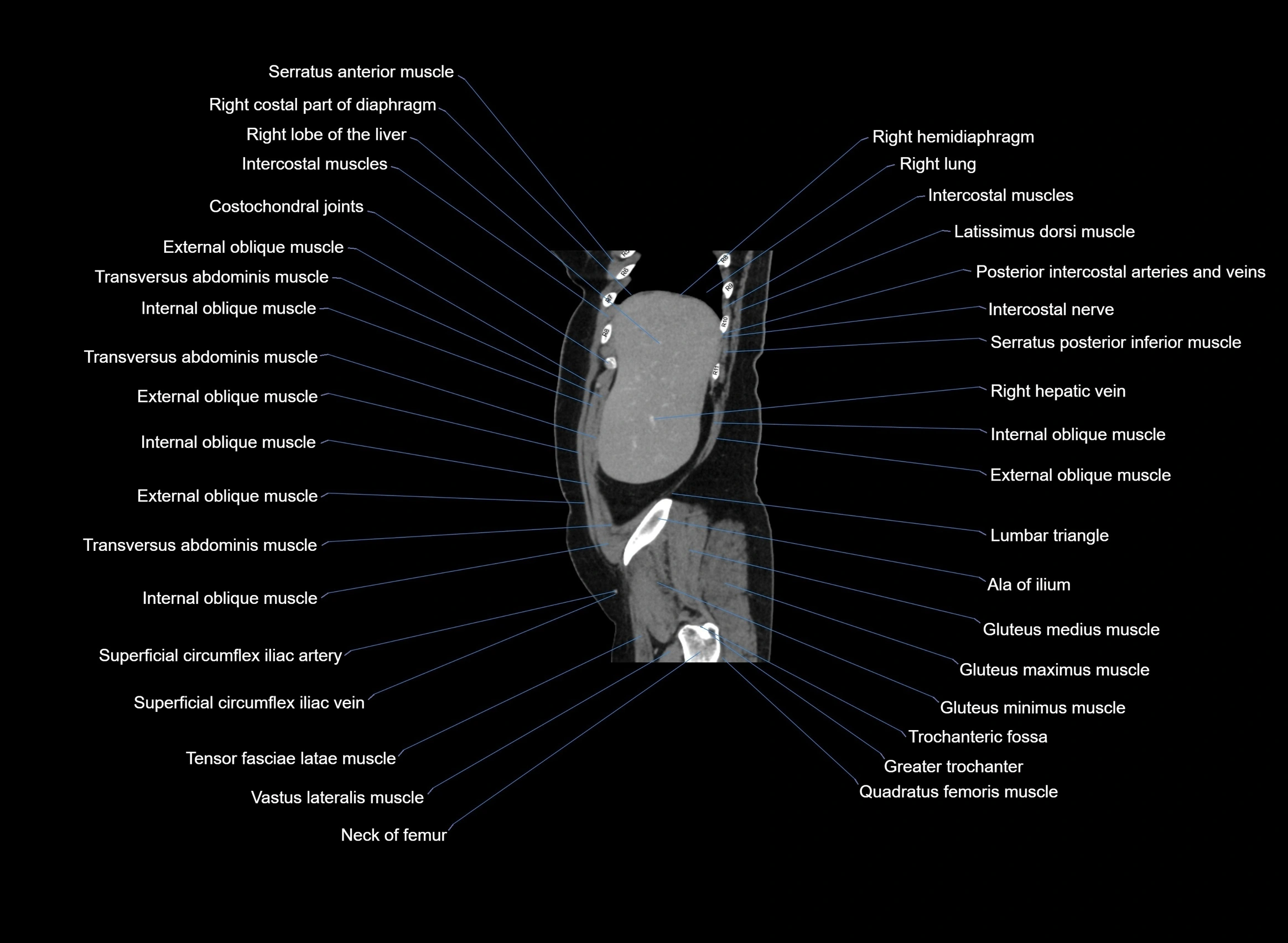 CT Abdomen sagittal cross sectional anatomy labelled radiology image -00097.webp